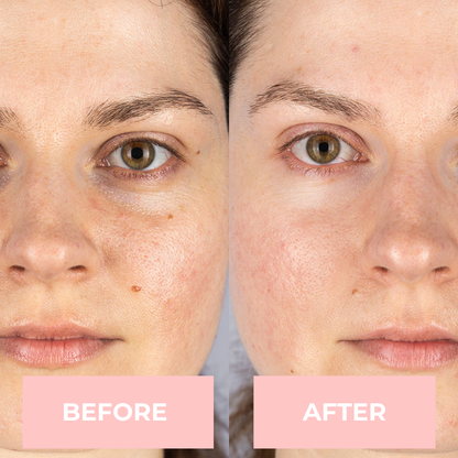 Lux Cove 7-in-1 LED Face Mask