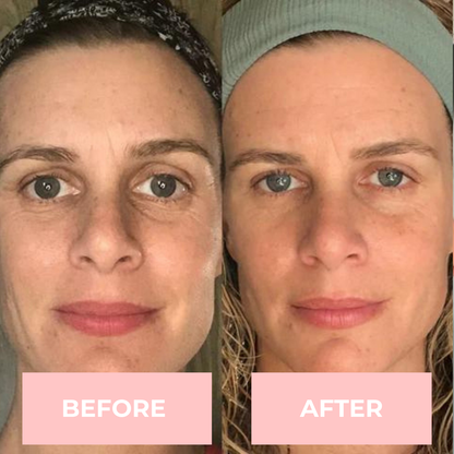 Lux Cove 7-in-1 LED Face Mask