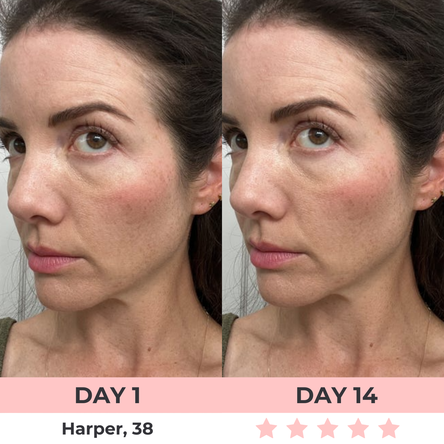 Lux Cove Red Light Under-Eye Glasses