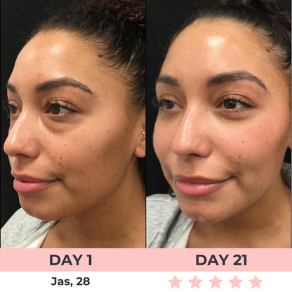 Lux Cove Red Light Under-Eye Glasses