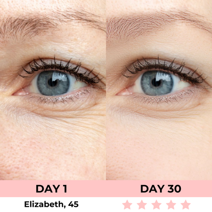 Lux Cove Red Light Under-Eye Glasses