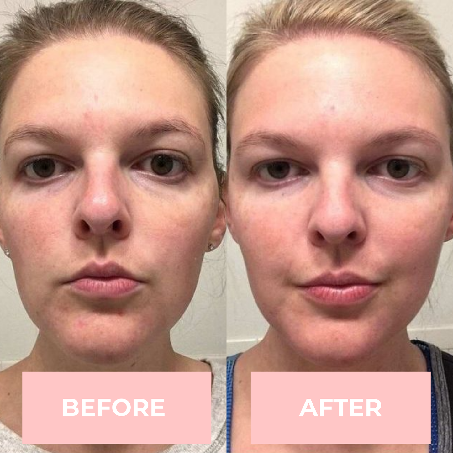 Lux Cove 7-in-1 LED Face Mask