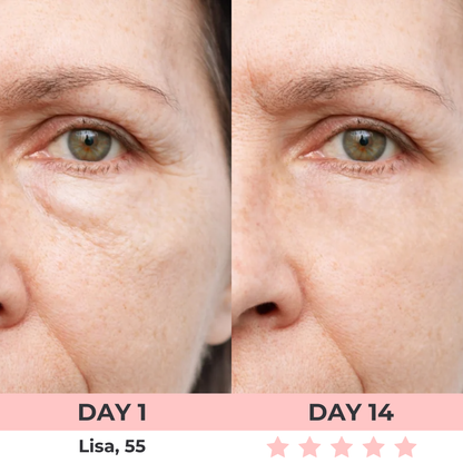 Lux Cove Red Light Under-Eye Glasses